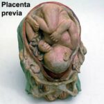 Tratamiento de la menopausia y climaterio