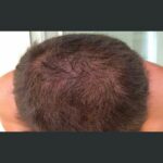 Videos de ansiedad y estres