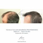 Los perros tienen depresion