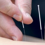 Mioclonia y dolor de cabeza