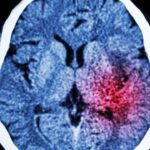 Cancer de pancreas y depresion