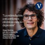 Molestias en la cabeza por ansiedad