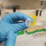Secuelas del dengue dolor de cabeza