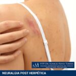 Dolor de cabeza luego de comer