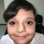 Diferencia entre mioclonias y convulsiones