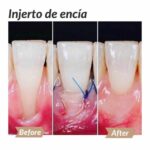 Dolor del trigemino por estres