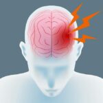 Neuralgia del trigémino medicamentos