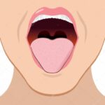 Hipoventilacion mioclonias
