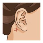 How common is occipital neuralgia