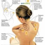 Dolor del trigemino por estres