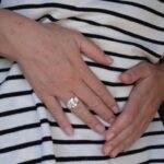 Como aliviar sintomas de la menopausia