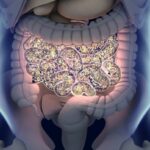 Tamaño del endometrio en la menopausia