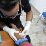 Como calmar el dolor de neuralgia posherpética