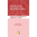 Como calmar el dolor de neuralgia posherpética