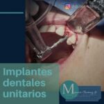 Tiron en el cuello y dolor de cabeza