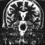 Ansiedad y dolor de cabeza despues de comer