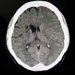 Videos de autoayuda para la depresion