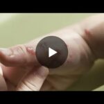 Piernas flojas ansiedad foro