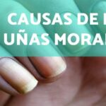 Ingreso hospitalario por ansiedad