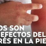 Ayuno intermitente y ansiedad